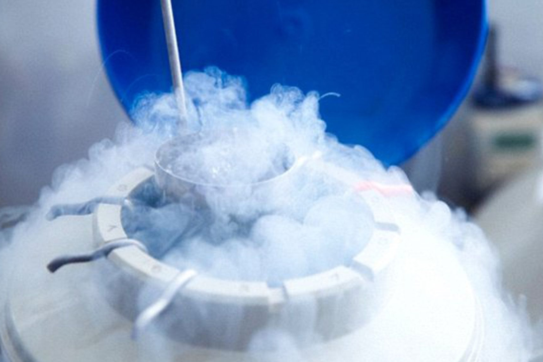 sperm freezing